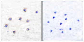 TH (phospho-Ser62) antibody