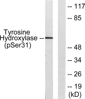 TH (phospho Ser62) rabbit pAb
