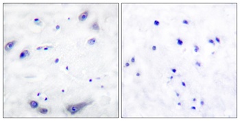 Tyrosine Hydroxylase rabbit pAb