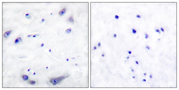 TH antibody