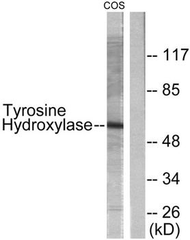 TH antibody