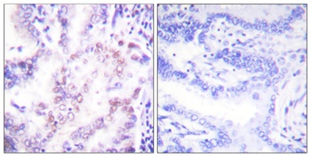 TRβ1 rabbit pAb Antibody