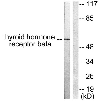 TRβ1 rabbit pAb