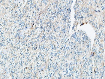 Tie-1 rabbit pAb Antibody