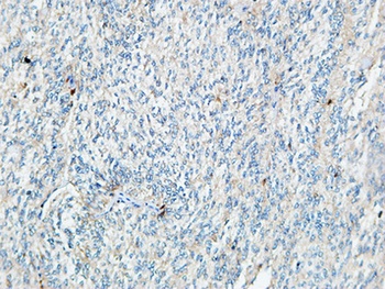 Tie-1 antibody