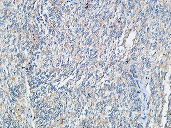 Tie-1 antibody