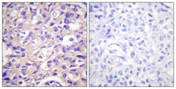 Thymidine Kinase (phospho Ser13) rabbit pAb