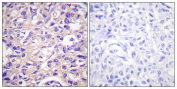 Thymidine Kinase (phospho-Ser13) antibody