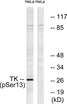 Thymidine Kinase (phospho-Ser13) antibody