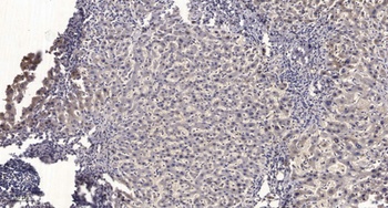 Thymidine Kinase antibody