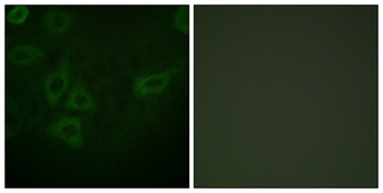 Thymidine Kinase antibody