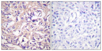 Thymidine Kinase rabbit pAb