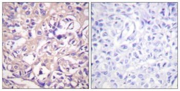 Thymidine Kinase antibody