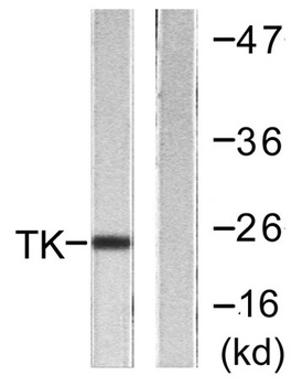 Thymidine Kinase antibody