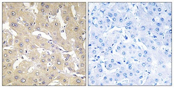 TNFα-IP 2 rabbit pAb