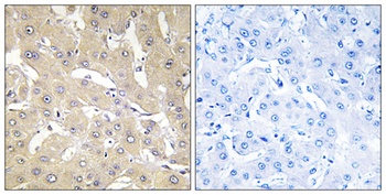 TNFalpha-IP 2 antibody