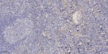 TSG-6 antibody