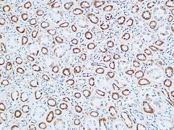 TNF-R1 antibody