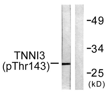 Troponin I-C (phospho Thr142) rabbit pAb