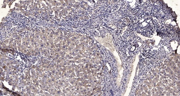 Troponin I-C (phospho Thr142) rabbit pAb