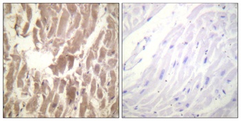 Troponin I-C (phospho-Ser43) antibody