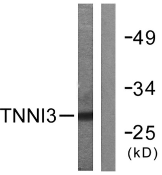 Troponin I-C rabbit pAb
