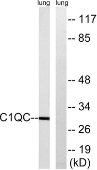 C1q-C antibody