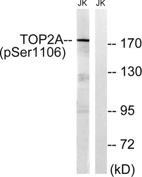 Topo II alpha (phospho-Ser1106) antibody