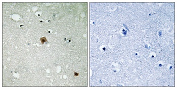 Topo IIα (phospho Ser1525) rabbit pAb