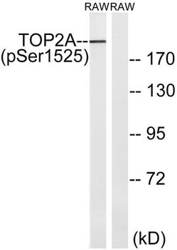 Topo IIα (phospho Ser1525) rabbit pAb