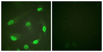 p53 (Acetyl Lys381) antibody