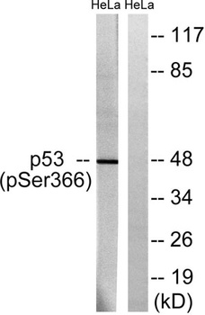 p53 (phospho-Ser366) antibody