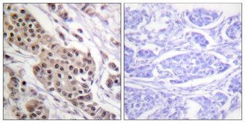 p53 (phospho-Ser392) antibody