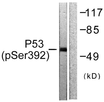 p53 (phospho-Ser392) antibody