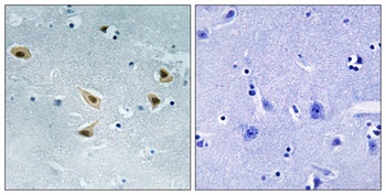 p53 (phospho-Ser376) antibody