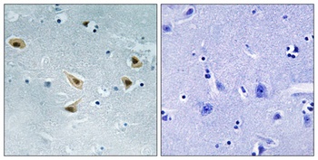 p53 (phospho Ser376) rabbit pAb