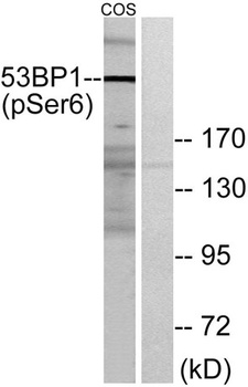 53BP1 (phospho-Ser6) antibody
