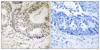 53BP1 (phospho Ser25) rabbit pAb