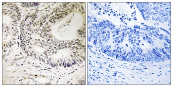 53BP1 (phospho-Ser25) antibody