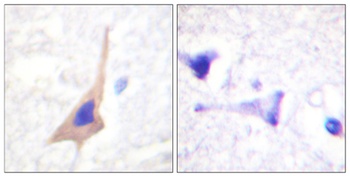 TPH1 (phospho Ser58) rabbit pAb