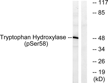 TPH1 (phospho Ser58) rabbit pAb