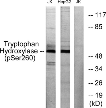 TPH1 (phospho-Ser260) antibody