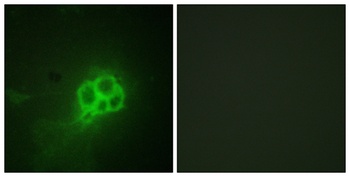 TPH1 antibody