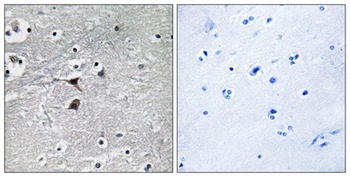 TPH1 rabbit pAb