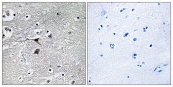 TPH1 antibody