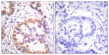 Tuberin (phospho-Ser939) antibody