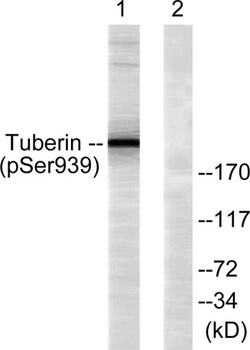 Tuberin (phospho Ser939) rabbit pAb