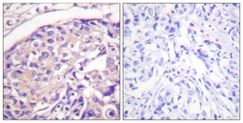 Tuberin (phospho-Thr1462) antibody