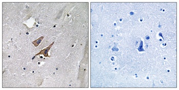 Tuberin (phospho-Tyr1571) antibody