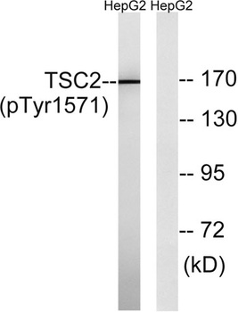 Tuberin (phospho-Tyr1571) antibody